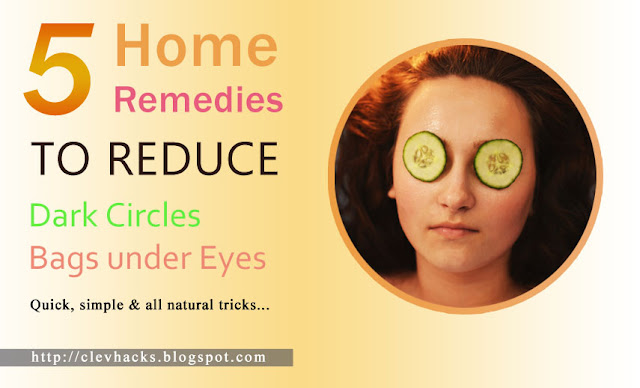 5 Home Remedies for Dark Circles and Bags under Eyes