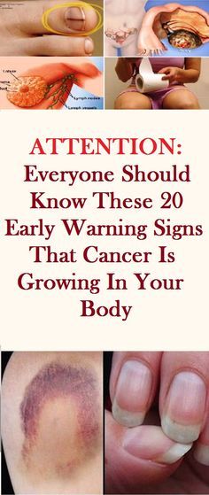 18 Warning Signs That Cancer is Growing in Your Body (Don’t Ignore Them!)