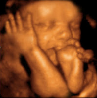 3d Ultrasound Images3