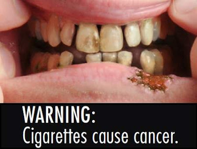 Cigarettes cause cancer
