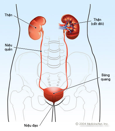 Sỏi niệu quản - Triệu chứng, biến chứng và cách chữa trị