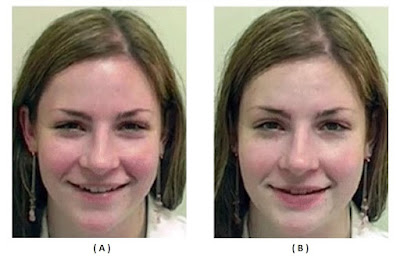 WHICH ONE IS THE GENUINE SMILE OR DUCHENNE SMILE ? (YANG MANAKAH YANG MERUPAKAN SENYUM YANG ASLI, SENYUM YANG TULIS, SENYUM YANG SPONTAN ?)