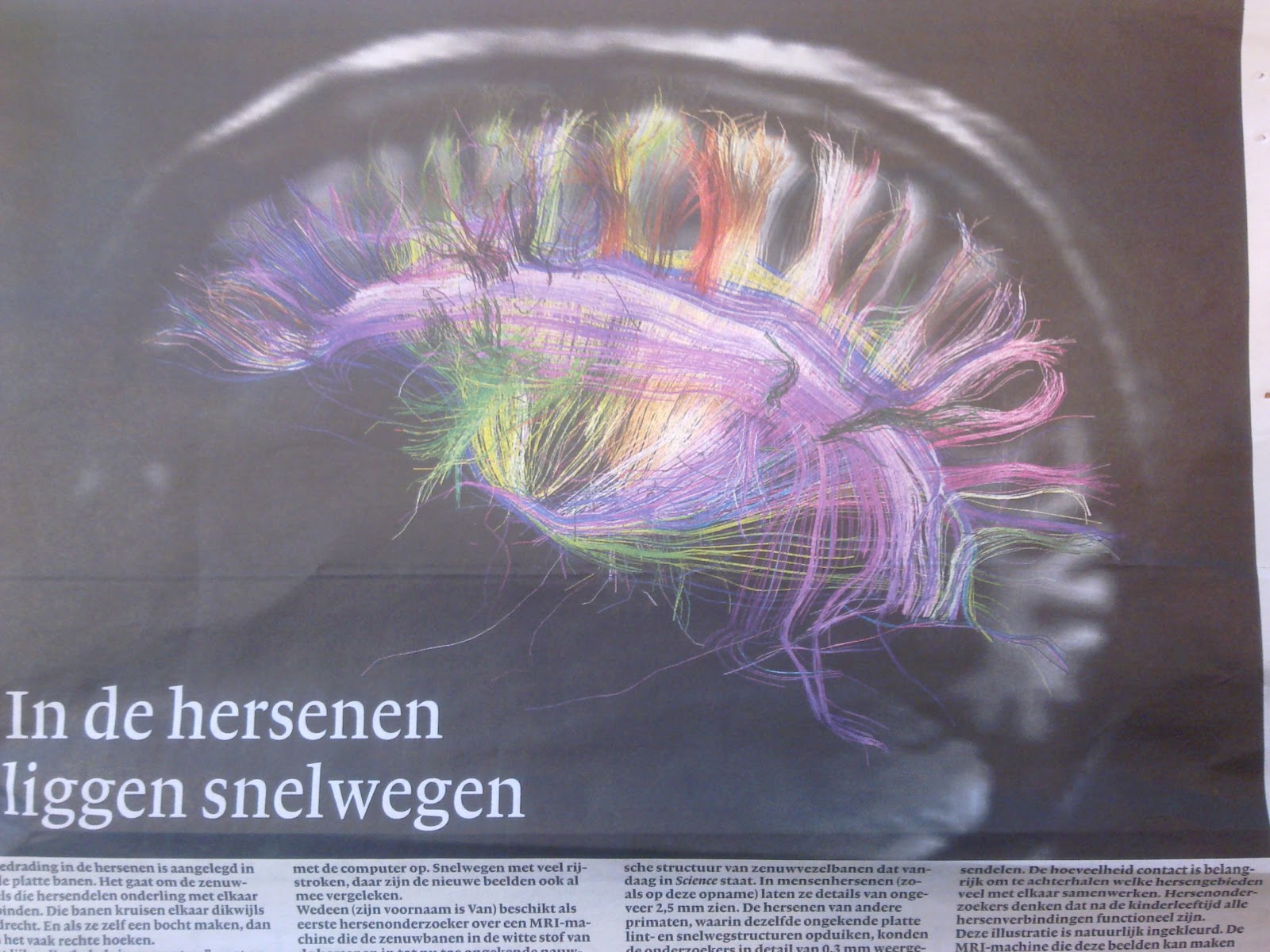... Van Wedeen (NIMH) made this MRI-scan (NRC Handelsblad 30 March 2012