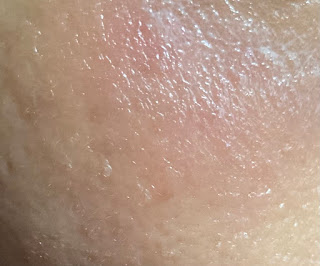 확대 무보정 붉은기 따가움 민감성 피부 사용