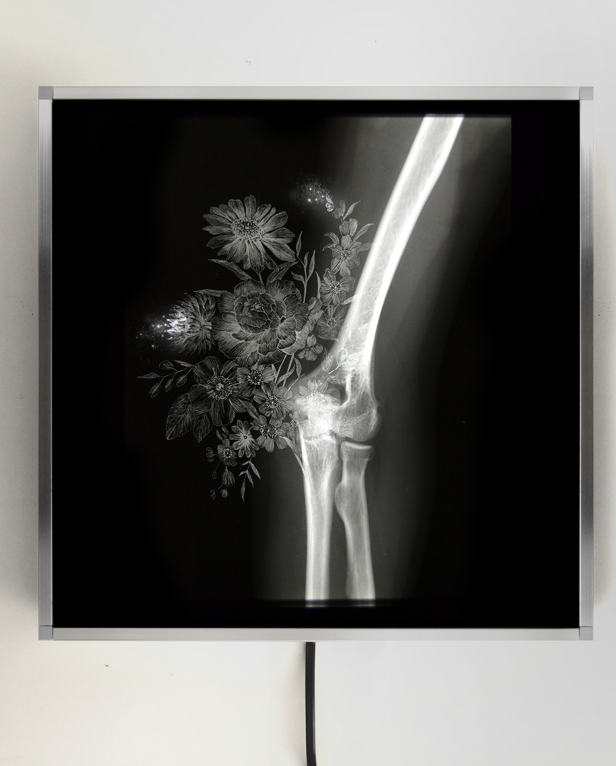 Nunzio Paci - Arthrosis, manually altered x-ray on LED lightbox