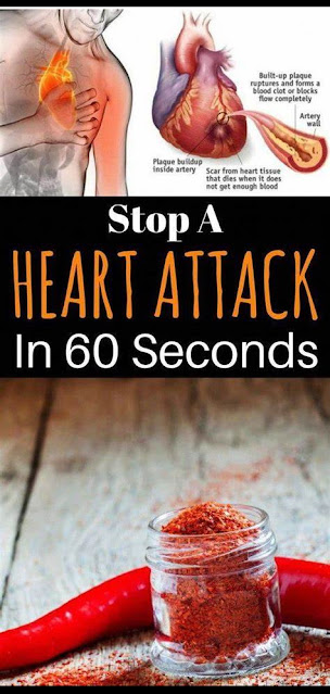 How To Stop A Heart Attack In 60 Seconds- This Is A Very Popular Ingredient!