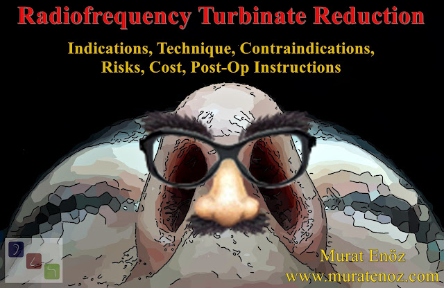 Radiofrequency Turbinate Reduction in Istanbul - Radiofrequency Turbinate Reduction in Turkey - Radiofrequency Turbinate Reduction Indications, Technique, Contraindications, Risks, Cost, Post-op Instructions - Turbinate Hypertrophy Treatment in Istanbul - Turbinate Hypertrophy Treatment in Turkey - Turbinate Radiofrequency in Istanbul - Turbinate Radiofrequency in Turkey