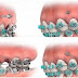 Những ảnh hưởng của răng mọc lệch lạc