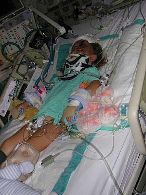 Graeme unconscious in his ICU bed, full body shot, tubes everywhere.