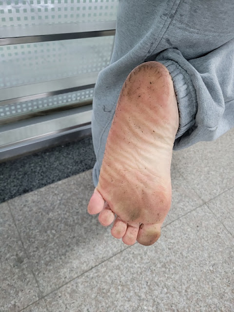 沾上泥土的脚最健康最乾淨，泥土很容易洗掉。