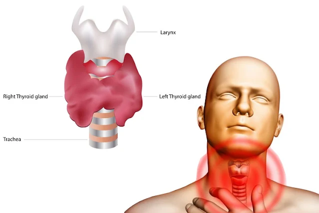 The Connection Between Your Thyroid and Chronic Pain That Doctors Miss Every Time