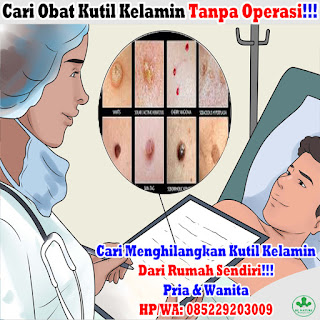 Obat Penghilang Kutil Kelamin