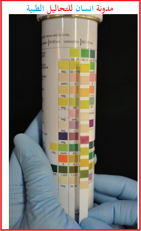 Urine chemical reagent testing strip