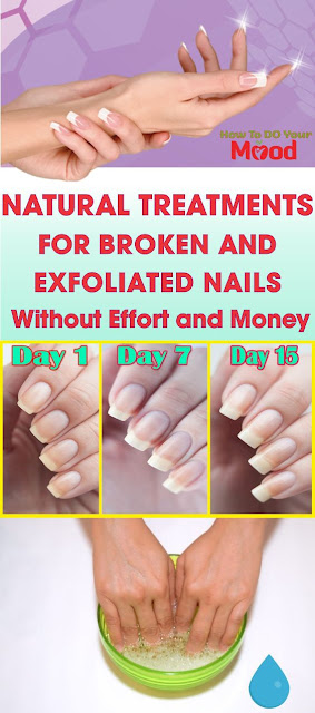 Natural Treatments For Broken and Exfoliated Nails Without Effort and Money