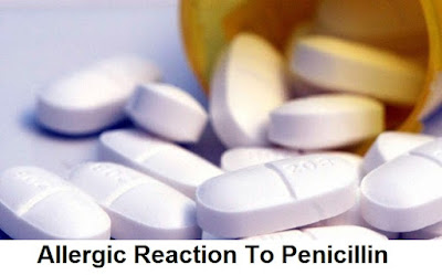 Allergic Reaction To Penicillin - Symptoms And Treatment