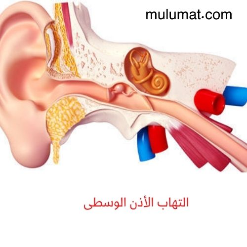 أعراض التهاب الأذن الوسطى وكيفية علاجها للصغار والكبار