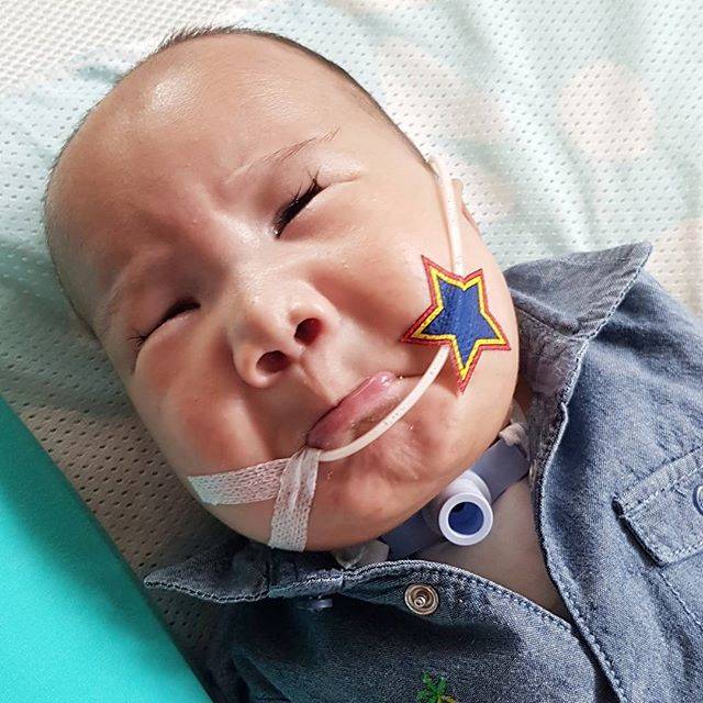 Subhanallah..!! Bayi Adam Fabumi Meninggal Dalam Keadaan Tersenyum Indah