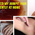 How I removed my armpit hair permanently at Home  Body Hair Removal