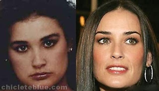 Demi Moore antes de fazer plastica