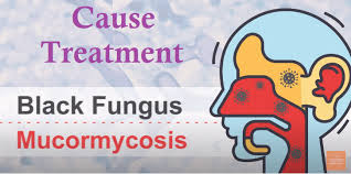 what is black fungus or mucormycosis  in simple words 2021 ?