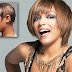 Regain Your Gorgeous Hair with Effective Hair Replacement Treatments