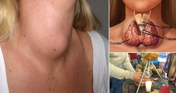 This Popular Drink Destroys Your Thyroid. Do You Consume It?