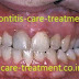 Tooth-care-treatment
