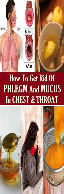 How to Get Rid of Phlegm and Mucus in Chest & Throat
