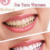 Amazing Home Remedies For Teeth Whitening