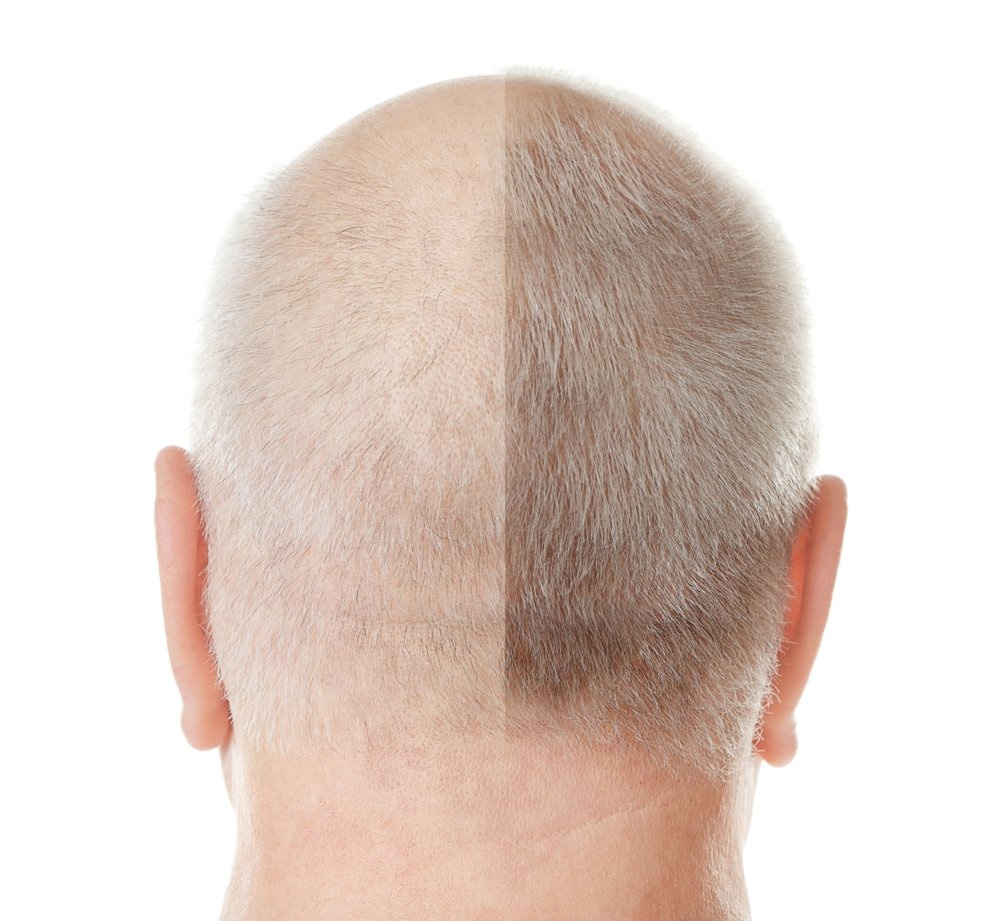 hair loss blocker funciona?