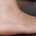 Dry Feet solution | Lush web