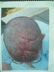 WARNING! GRAPHIC MEDICAL PHOTOS