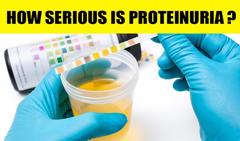 How serious is proteinuria?