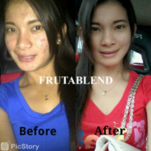 FRUTABLEND KLATEN Kanigoro<br/>