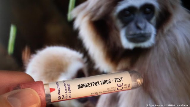 Primeiro caso de varíola dos macacos no Brasil é confirmado na cidade de São Paulo