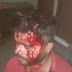 सिटी कोतवाली के पास व्यापारी और उसके भाई के ऊपर रोड ईंट से हमला, गंभीर हालत में घायल व्यापारी अस्पताल में भर्ती  गुंडों ने व्यापारी के साथ की मारपीट सीसीटीवी वायरल