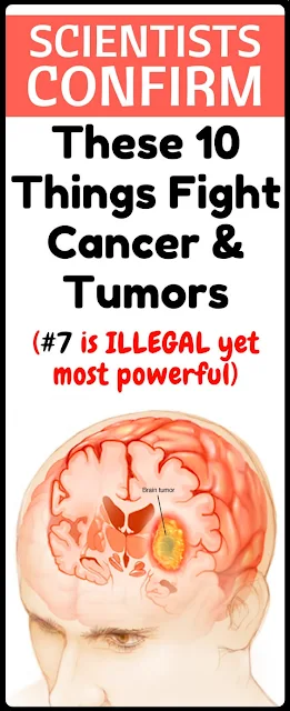Scientists Confirm! These 10 Tings Fight Cancer And Tumors