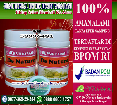 OBAT HERBAL UNTUK EKSIM PADA BAYI