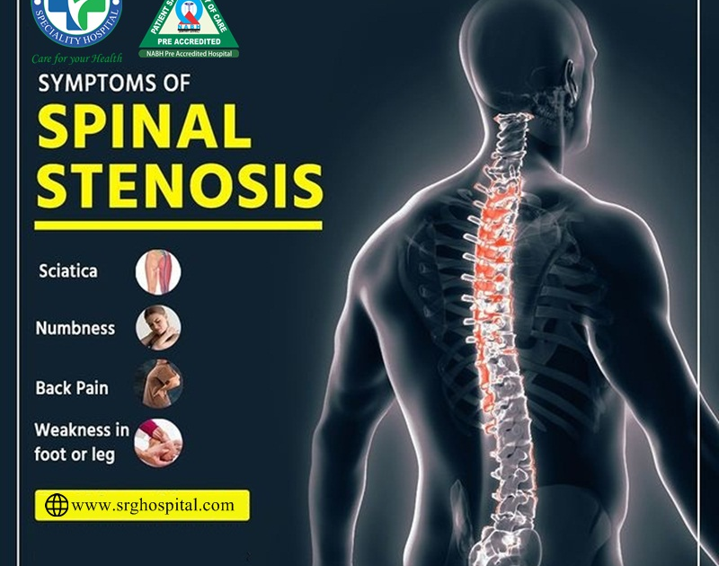Injuries And Disorders Of The Spine Are Treated By Spine Surgeons In Delhi