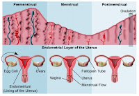  jenis penyakit yang dapat menyerang wanita