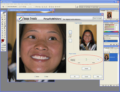 Image Trends Pearly Whites v2.1.2, Photoshop Plug-Ins, Photoshop Stuff