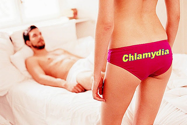 chlamydia