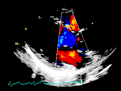 Echocardiography