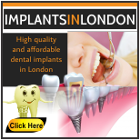 Dental implants in London