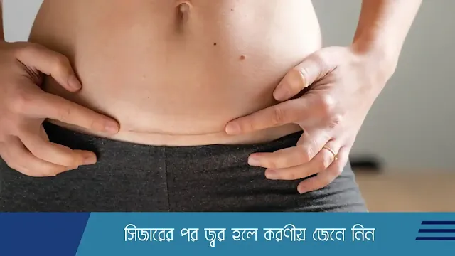 সিজারের পর জ্বর হলে করণীয় জেনে নিন