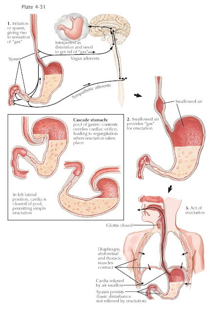 AEROPHAGIA AND BELCHING