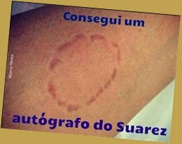 suarez