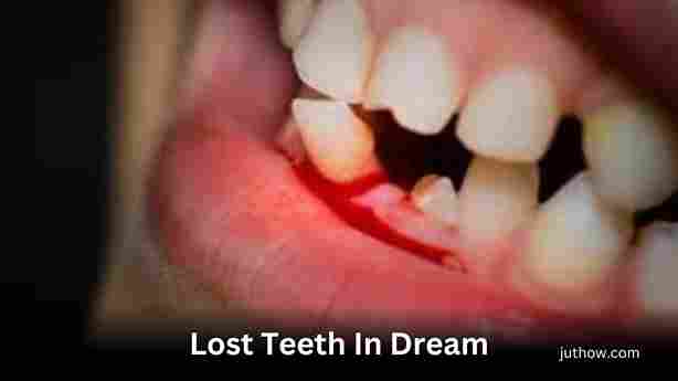 lost teeth in dream