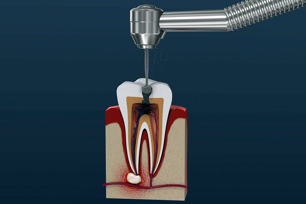 Endodontia