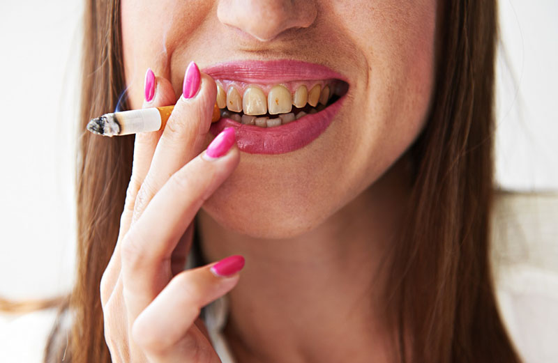 12 Ways Smoking Cigarettes Ruins Your Looks